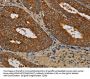 KCNK17 Antibody