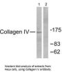 COL4A1 Antibody