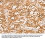 CPB1 Antibody