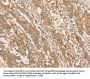 CPB1 Antibody