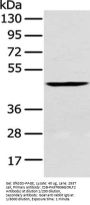 CRLF2 Antibody