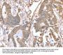 ABCB6 Antibody