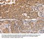 ABCB6 Antibody