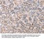 TCERG1L Antibody
