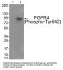 Phospho-FGFR4 (Tyr642) Antibody