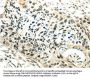 SYNCRIP Antibody
