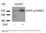 Phospho-EGFR (Thr693) Antibody