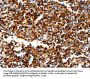 Rabbit anti-human NCOR1 polyclonal antibody