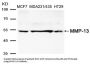 MMP13 Antibody