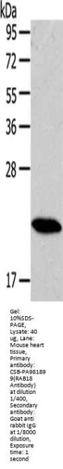 RAB18 Antibody
