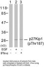 Phospho-CDKN1B (Thr187) Antibody