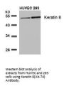 KRT8 (Ab-74) Antibody