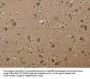 PTK2B Antibody