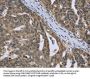 PTK2B Antibody