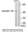KRT16 Antibody