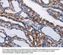 Rabbit anti-human NFKBIA polyclonal antibody