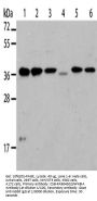 Rabbit anti-human NFKBIA polyclonal antibody