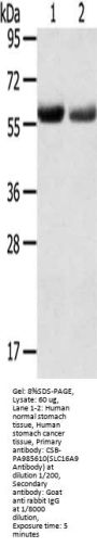Rabbit anti-human SLC16A9 polyclonal antibody