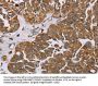 NOV Antibody