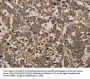 NOV Antibody