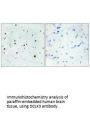 DCLK3 Antibody