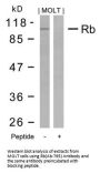 RB1 (Ab-795) Antibody