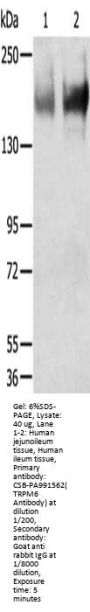 Rabbit anti-human TRPM6 polyclonal antibody