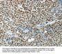 HNRNPM Antibody