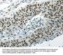 HNRNPM Antibody