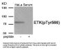 Phospho-BMX (Tyr566) Antibody