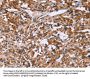 LAMP2 Antibody