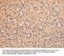 AP2A1 Antibody