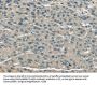 UGP2 Antibody