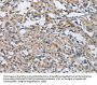 PTK6 Antibody