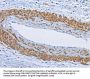PTK6 Antibody