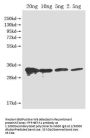 PFP-BETA1 Antibody