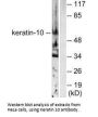 KRT10 Antibody