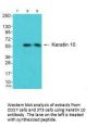 KRT10 Antibody