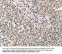 CDK12 Antibody