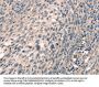 CDK12 Antibody