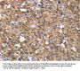 CEACAM6 Antibody