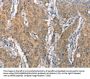 CEACAM6 Antibody
