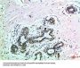 EPHB3 Antibody