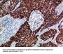 EPHB3 Antibody
