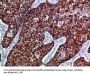 EPHB3 Antibody