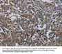 EPHA10 Antibody
