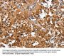 Rabbit anti-human CAMK1D polyclonal antibody