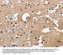 Rabbit anti-human CAMK1D polyclonal antibody