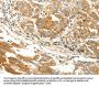 AGRP Antibody