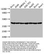 ACTA1 Recombinant Monoclonal Antibody